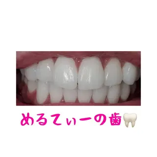 MBEAUTYSALON 千葉店・京成大久保所属・Melty 輝のその他イメージ