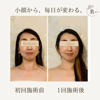 小顔サロンラヴィ　　船橋馬込沢店所属・小顔サロンラヴィ 船橋のエステ・リラクイメージ
