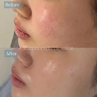 Rumia Salonのエステ・リラクイメージ