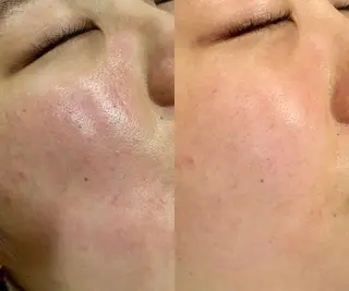 メンズ 大阪脱毛|ちぇるま| 眉毛Wax｜美肌管理のエステ・リラクイメージ