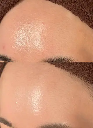 お肌のかかりつけサロンP.A.L.M.所属・【P.A.L.M.】 むき卵×毛穴レス肌のエステ・リラクイメージ