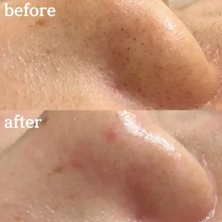 毛穴専門サロンLatiele所属・毛穴専門サロン Latieleのエステ・リラクイメージ