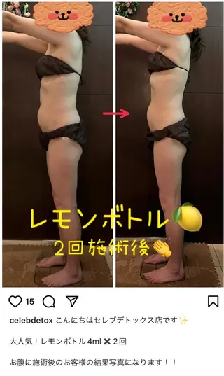 Anne 眠質改善 小顔脳洗浄®︎所属・Anneオーナー Ananのエステ・リラクイメージ