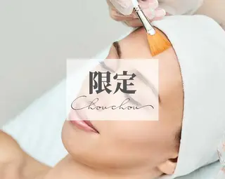 beauty & health salon Chou chou所属・ニキビ・毛穴🌿肌を 育てるララピール✨のエステ・リラクイメージ