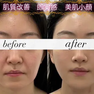 愛維美水光美肌専門店所属・愛維美水光美肌専門店 メンズレディースokのエステ・リラクイメージ