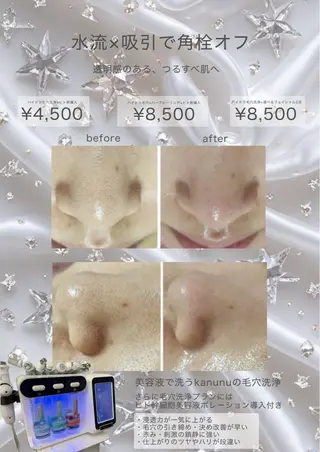 Kanunu所属・鶴橋エステ kanunuのエステ・リラクイメージ