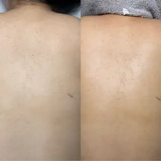 肌質改善サロンand...所属・肌質改善サロン and...のエステ・リラクイメージ