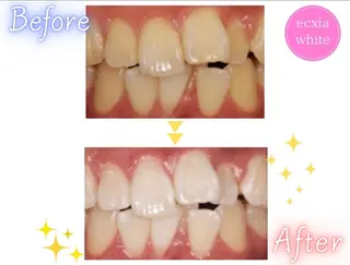 エクシアホワイト エミフルMASAKIのその他イメージ