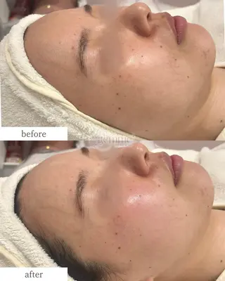 美の宝石屋さん gemme【ジェム】所属・gemme -ジェム-のエステ・リラクイメージ