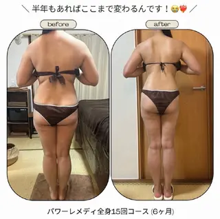 biloop所属・《痩身×疲労改善》 BILOOPのエステ・リラクイメージ