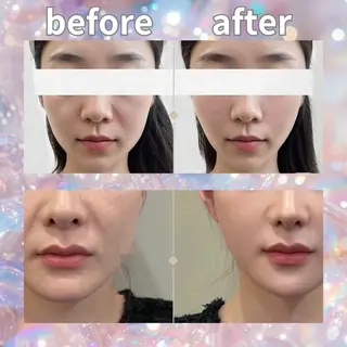 マツエク・マツパ aliaハイフ&水光ジェットサロン所属・aliaハーブ水光店 エステティシャン募集のエステ・リラクイメージ