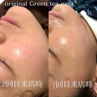 美肌salon GRAN CUORE所属・Natsuki🌙 GRAN CUOREのエステ・リラクイメージ