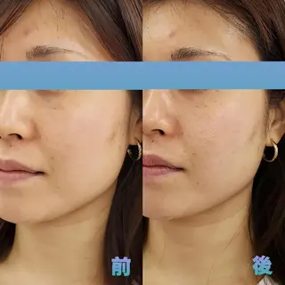 Nana no  Moeのエステ・リラクイメージ