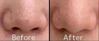 光フォト美容 エイジング、敏感肌のエステ・リラクイメージ