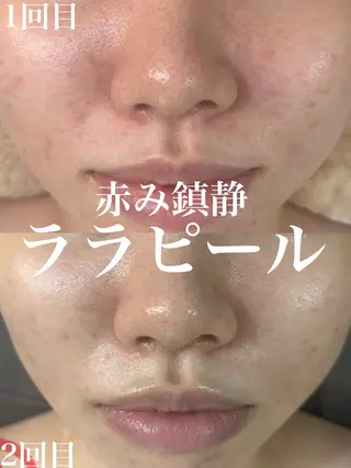 WHITE AQUA 北千住店のエステ・リラクイメージ