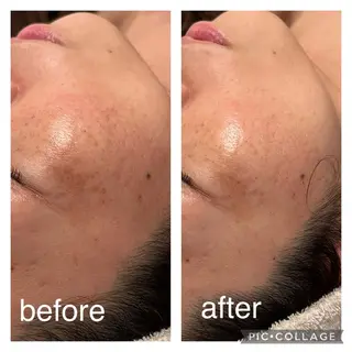 aimee　肌質改善サロン【アイミー】所属・肌質改善サロン aimee｜アイミーのエステ・リラクイメージ