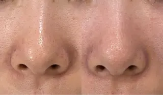 DeI'm   名古屋栄所属・小林 玲菜のエステ・リラクイメージ