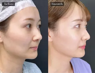 ネイル aliaハイフ&水光ジェットサロン所属・aliaハーブ水光店 エステティシャン募集のエステ・リラクイメージ