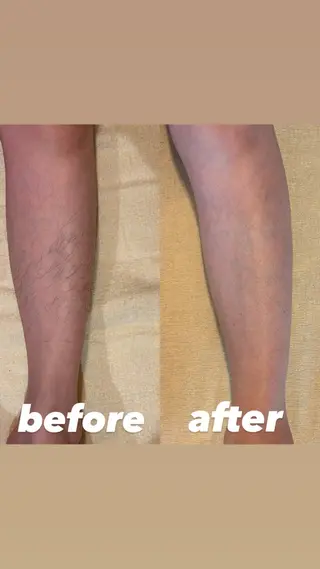 une所属・une シュガーリング脱毛のエステ・リラクイメージ