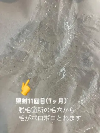 メンズ MISEREL岡崎店 Ayaのエステ・リラクイメージ