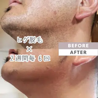 脱毛｜ピーリング ROOM.Sのエステ・リラクイメージ