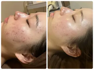 美u•p 鶴ヶ峰店のマツエク・マツパデザイン