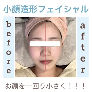 エステサロン JURISのエステ・リラクイメージ