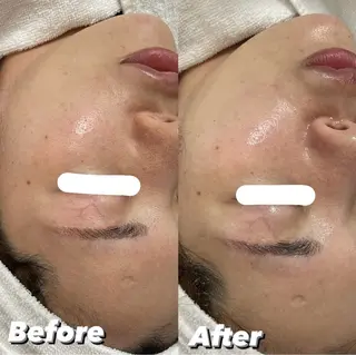 private salon éclat所属・ニキビ・毛穴専門 éclat/エクラのエステ・リラクイメージ