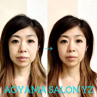 小顔美容鍼専門サロン 渋谷YZのエステ・リラクイメージ