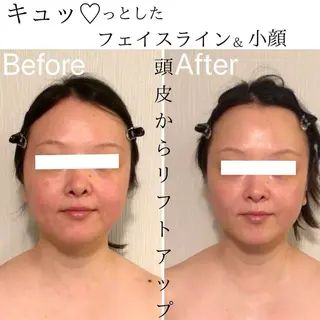 リフトアップ小顔 専門のエステ・リラクイメージ