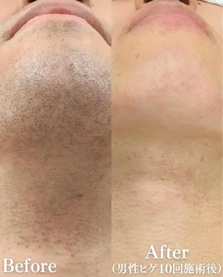 More   Beauty所属・More Beautyのエステ・リラクイメージ