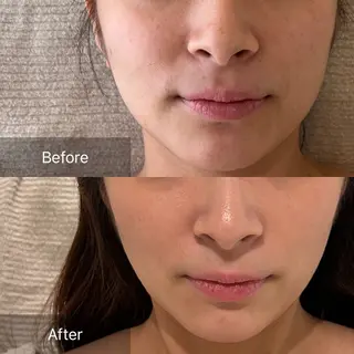 Charis エステ&ネイルのエステ・リラクイメージ