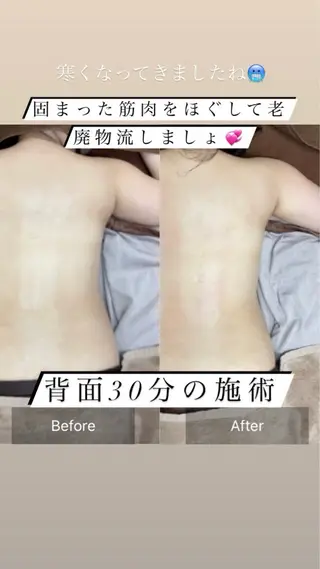 Ｂ&H所属・頭痛•肩こり専門/ 眉サロンB&H心斎橋のエステ・リラクイメージ