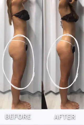 美容整体・塗る漢方・フェイシャルRechica所属・心斎橋痩身 美肌整体サロン💓のエステ・リラクイメージ