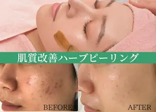 BestBelleꕤ 大阪福島/肌質改善のエステ・リラクイメージ