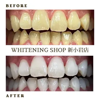 メンズ ホワイトニング ショップ新小岩店のその他イメージ