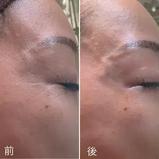 Ring -femのエステ・リラクイメージ