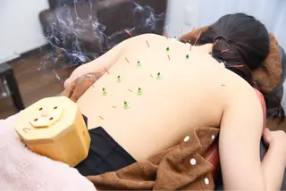 小顔ハーブピーリング 美容鍼/毛穴洗浄のエステ・リラクイメージ