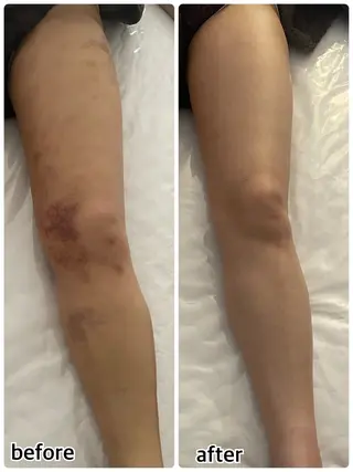 💎インディバ GEM💎indiba   healing room GEM所属・💎 GEM💎のエステ・リラクイメージ