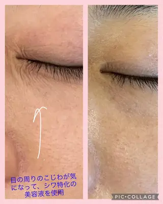 🅖🅤🅩🅔🅛 salonのエステ・リラクイメージ