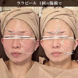 トータルビューティー サロンキノセ折井のエステ・リラクイメージ