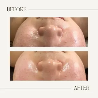 1st｜フェイシャル エステ専門店のエステ・リラクイメージ