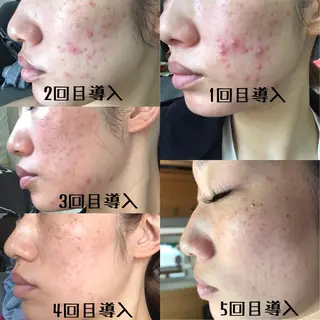 withサロン所属・withサロン/パリ 2600円サロンのマツエク・マツパデザイン