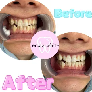 エクシアホワイトニング前橋店所属・セルフホワイトニング エクシア前橋店のその他イメージ