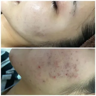 心斎橋痩身ダイエット 韓国.美容鍼.小顔のエステ・リラクイメージ