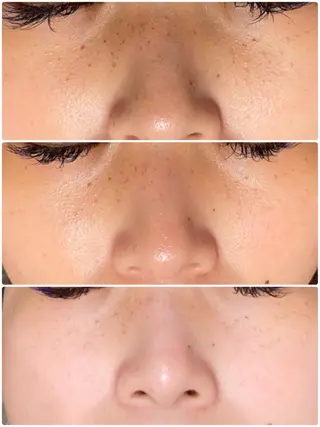 【EARTH鳥栖店】 小松美穂子のエステ・リラクイメージ