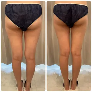 FLEURフェイシャ ル🫧ハーブ🌿小顔のエステ・リラクイメージ