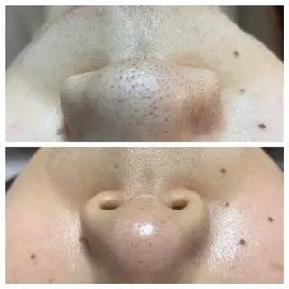 萩原 一樹のエステ・リラクイメージ