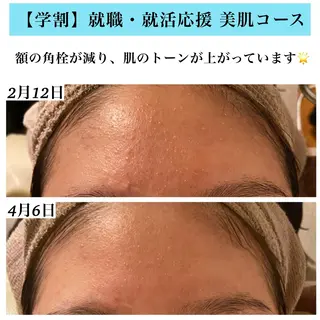 Bellesthe （ベルエステ）のエステ・リラクイメージ