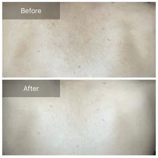 デ･アイム あま所属・かすみ🌹あま/ エステのエステ・リラクイメージ